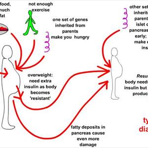 Diabetic Menu Ideas - How To Reverse Diabetes - The All Natural Way To Reverse Diabetes