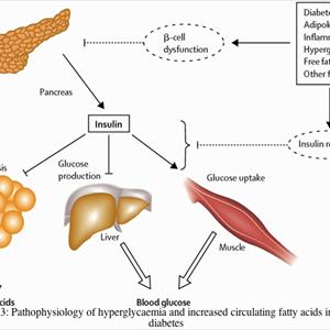 Latest Diabetes Drugs - Diabetes Can Be Cured-Scientists Agree