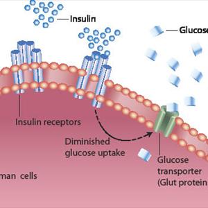 Type 1 Diabetes Cure - How Do You Get Type 2 Diabetes?